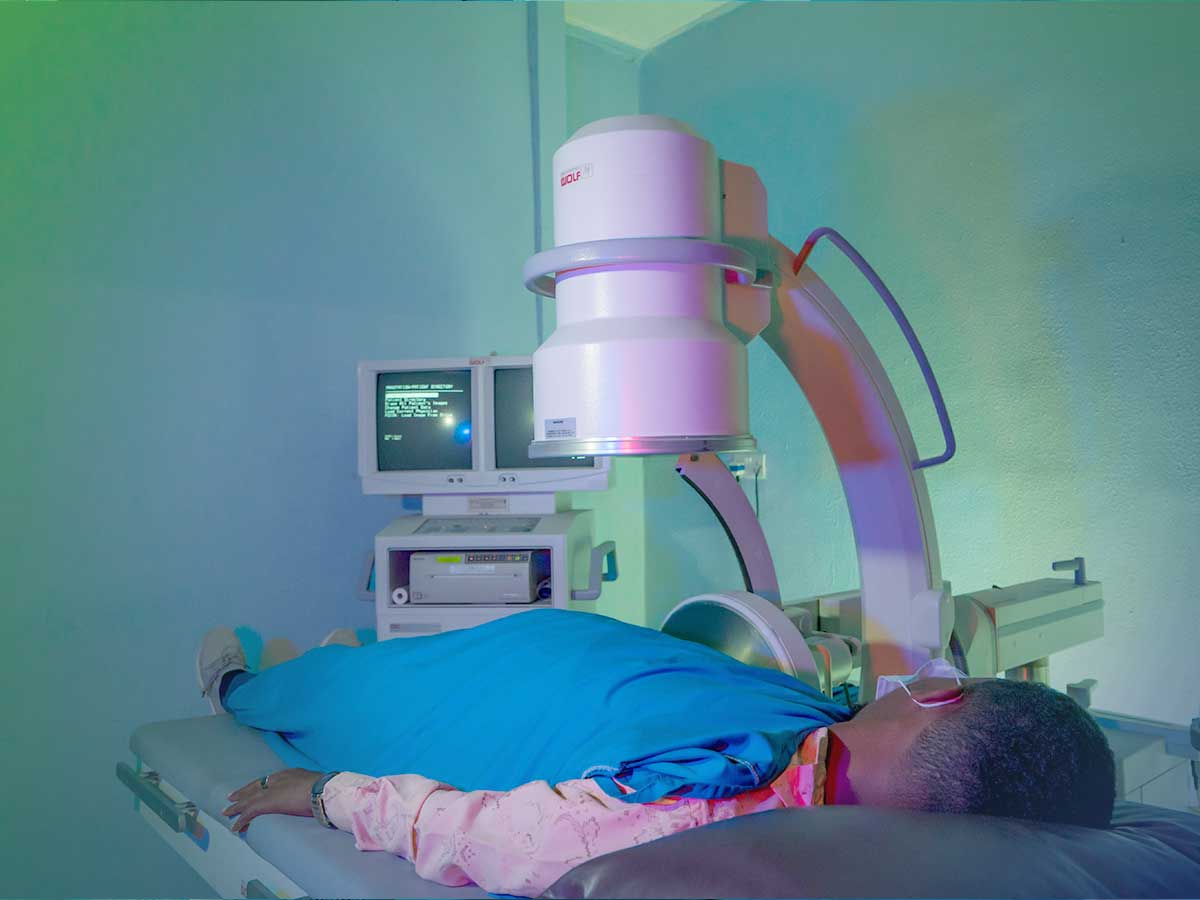 ESWL (extracorporeal shock waves lithotripsy)